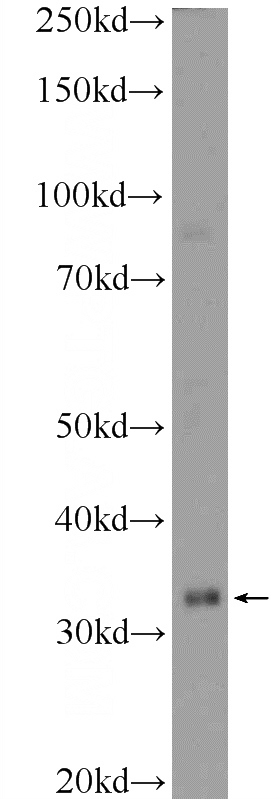 mouse liver tissue were subjected to SDS PAGE followed by western blot with Catalog No:109247(CEBPE Antibody) at dilution of 1:300