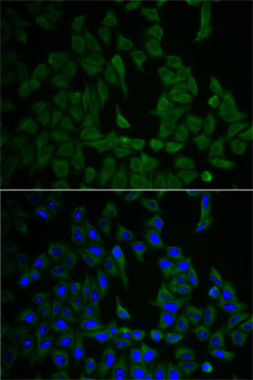 Immunofluorescence - NF2 Polyclonal Antibody 