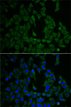 Immunofluorescence - NF2 Polyclonal Antibody 