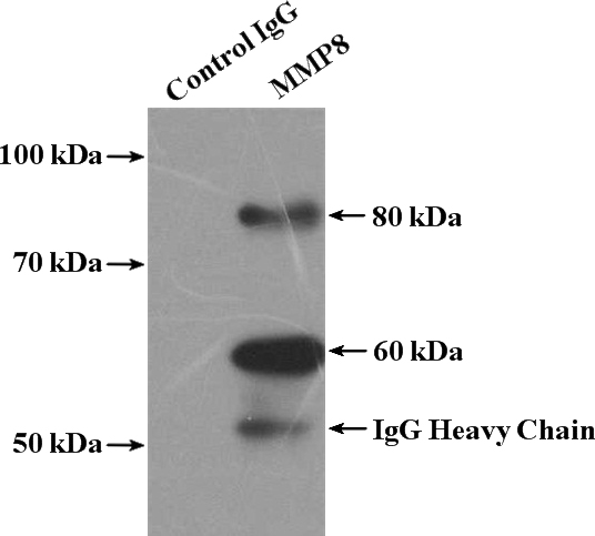 IP Result of anti-MMP8 (IP:Catalog No:112708, 4ug; Detection:Catalog No:112708 1:500) with mouse liver tissue lysate 3600ug.