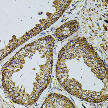 Immunohistochemistry - UQCRC1 Polyclonal Antibody 