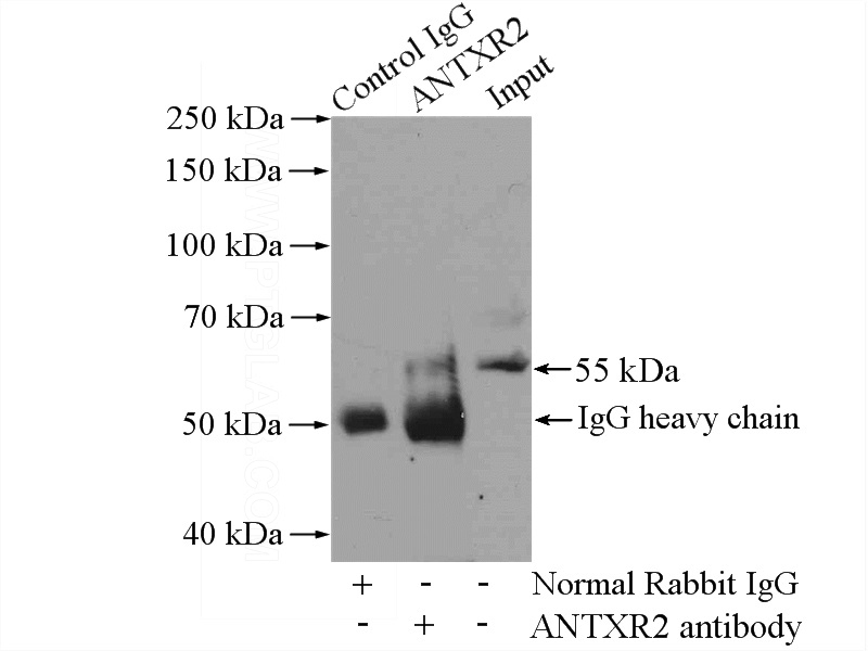 IP Result of anti-ANTXR2 (IP:Catalog No:108109, 4ug; Detection:Catalog No:108109 1:500) with HEK-293 cells lysate 2800ug.