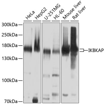 Western blot - IKBKAP Polyclonal Antibody 