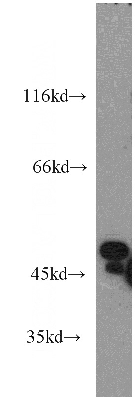 mouse pancreas tissue were subjected to SDS PAGE followed by western blot with Catalog No:108848(CPA2 antibody) at dilution of 1:2000