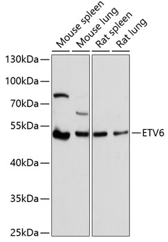 Western blot - ETV6 Polyclonal Antibody 