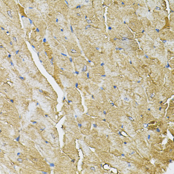 Immunohistochemistry - TRPC1 Polyclonal Antibody 