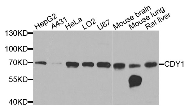 Western blot - CDY1 Polyclonal Antibody 