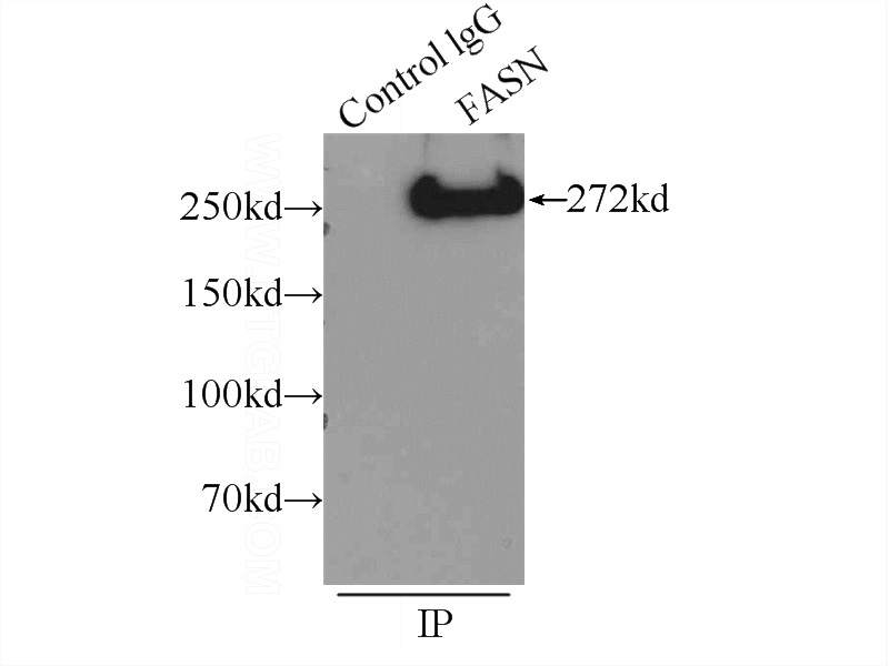 IP Result of anti-FASN (IP:Catalog No:110529, 4ug; Detection:Catalog No:110529 1:500) with mouse liver tissue lysate 4000ug.