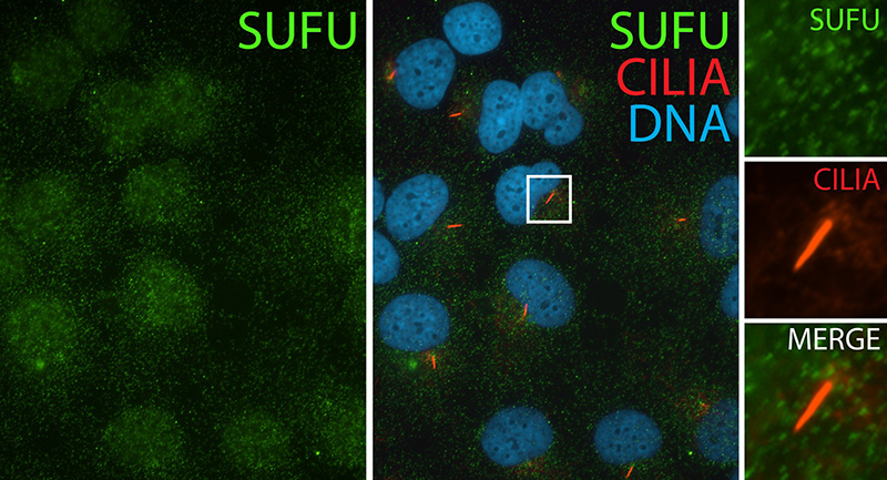 IF result (nuclear and cytoplasm stain) of anti-SUFU (Catalog No:115822, 1:50) with serum-starved hTERT-RPE1 cells by Dr. Moshe Kim.