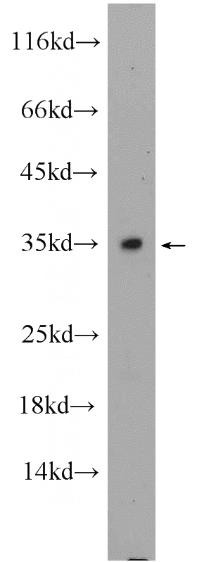 mouse testis tissue were subjected to SDS PAGE followed by western blot with Catalog No:108715(C2orf51 Antibody) at dilution of 1:300