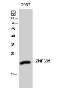 Fig1:; Western Blot analysis of 293T cells using ZNF695 Polyclonal Antibody diluted at 1: 2000. Secondary antibody（catalog#: HA1001) was diluted at 1:20000 cells nucleus extracted by Minute TM Cytoplasmic and Nuclear Fractionation kit (SC-003,Inventbiotech,MN,USA).