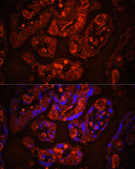 Immunofluorescence - CD31 Polyclonal Antibody 