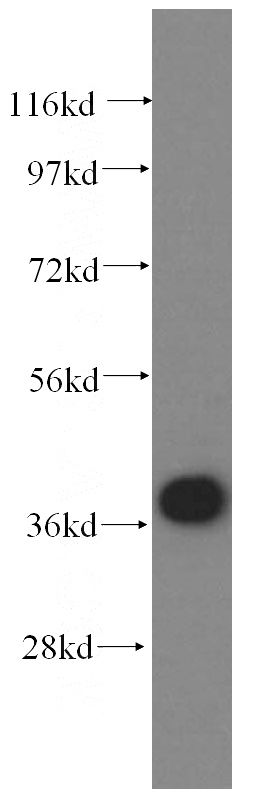 human brain tissue were subjected to SDS PAGE followed by western blot with Catalog No:114392(PSMC6 antibody) at dilution of 1:500