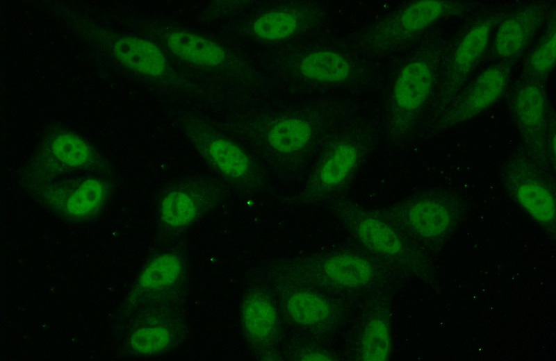 Immunofluorescent analysis of (10% Formaldehyde) fixed HepG2 cells using Catalog No:113030(NCAPD3 Antibody) at dilution of 1:50 and Alexa Fluor 488-congugated AffiniPure Goat Anti-Rabbit IgG(H+L)