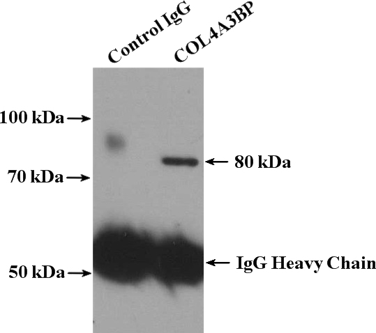 IP Result of anti-COL4A3BP (IP:Catalog No:109373, 4ug; Detection:Catalog No:109373 1:300) with mouse brain tissue lysate 3680ug.
