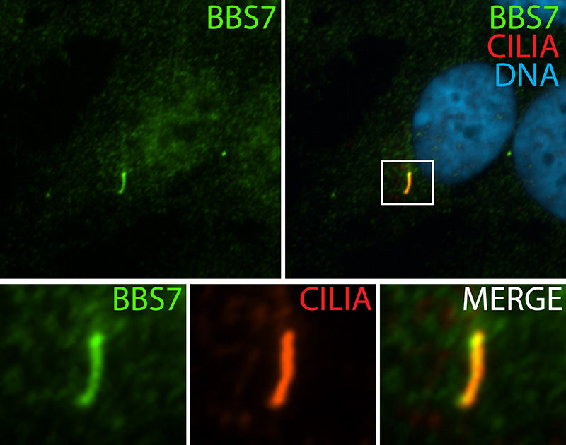 IF result (along the length of cilia stain) of anti-BBS7 (Catalog No:108374) with serum-starved hTERT-RPE1 cells (1% PFA fixed) by Dr. Moshe Kim.
