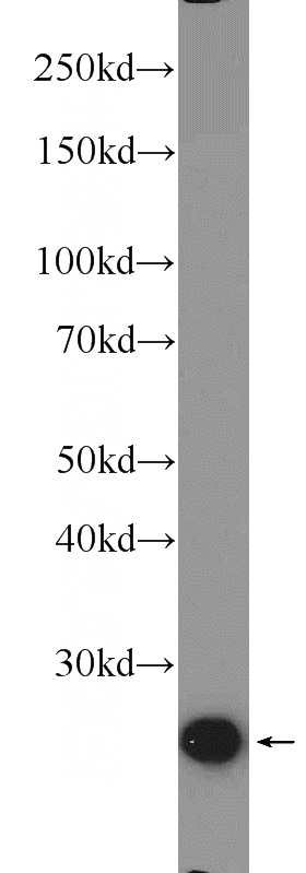 mouse thymus tissue were subjected to SDS PAGE followed by western blot with Catalog No:112721(MOBKL2A Antibody) at dilution of 1:1000