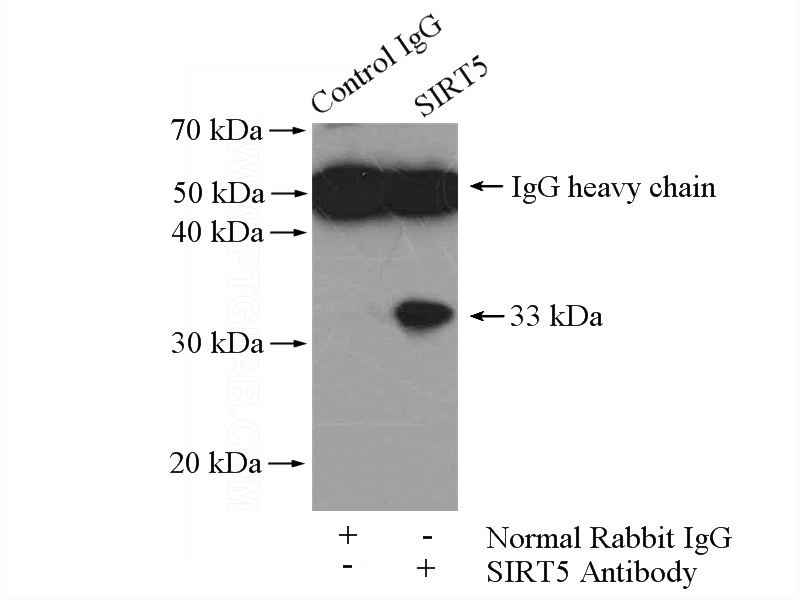 IP Result of anti-SIRT5 (IP:Catalog No:115246, 4ug; Detection:Catalog No:115246 1:500) with mouse liver tissue lysate 6000ug.