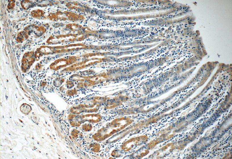 Immunohistochemistry of paraffin-embedded human stomach tissue slide using Catalog No:114458(RAB7A Antibody) at dilution of 1:50 (under 10x lens)