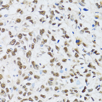 Immunohistochemistry - MTA3 Polyclonal Antibody 