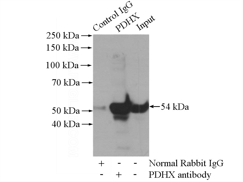IP Result of anti-PDHX (IP:Catalog No:113680, 4ug; Detection:Catalog No:113680 1:5000) with HEK-293 cells lysate 2000ug.