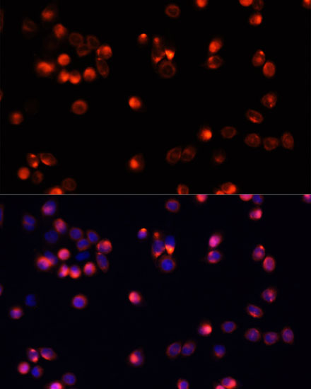 Immunofluorescence - AKT2 Polyclonal Antibody 