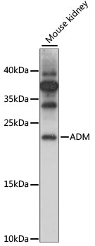 Western blot - ADM Polyclonal Antibody 