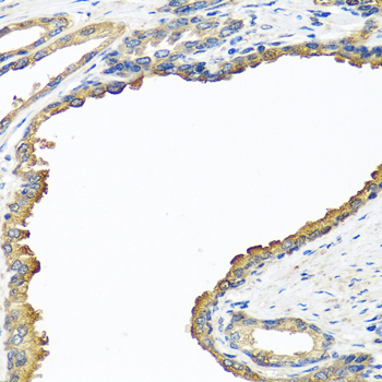 Immunohistochemistry - NYX Polyclonal Antibody 
