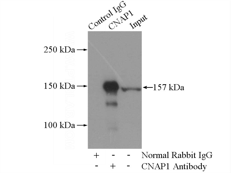 IP Result of anti-NCAPD2 (IP:Catalog No:113029, 4ug; Detection:Catalog No:113029 1:600) with HEK-293 cells lysate 2800ug.