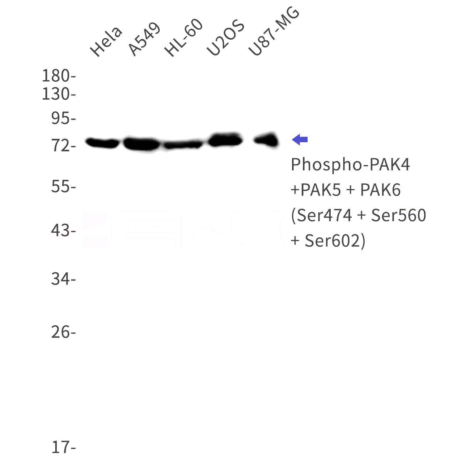 Western blot detection of Phospho-PAK4 + PAK5 + PAK6 (Ser474 + Ser560 + Ser602) in Hela,A549,HL-60,U2OS,U87-MG cell lysates using Phospho-PAK4 + PAK5 + PAK6 (Ser474 + Ser560 + Ser602) Rabbit mAb(1:1000 diluted).Observed band size:64,80,75kDa.
