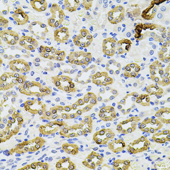 Immunohistochemistry - PIK3CA Polyclonal Antibody 