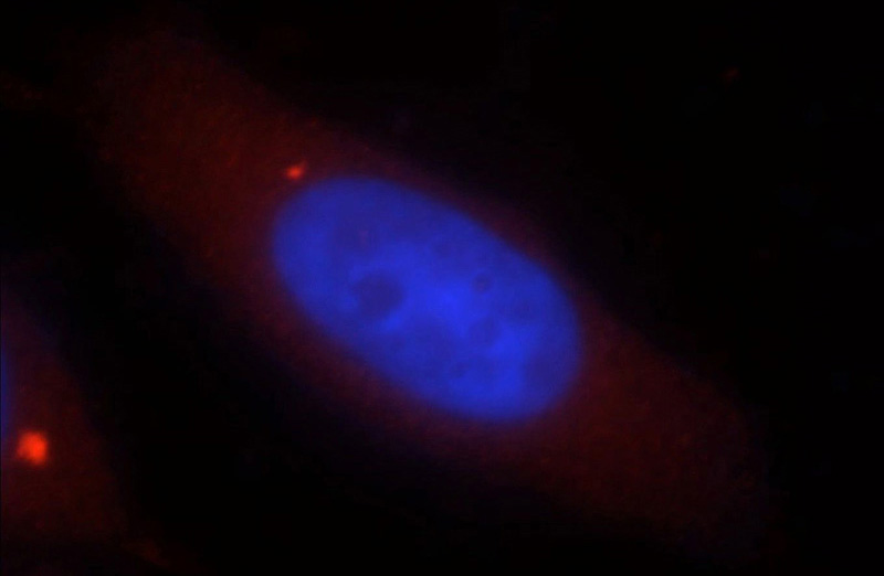 Immunofluorescent analysis of MCF-7 cells, using DNASE1L1 antibody Catalog No:109958 at 1:25 dilution and Rhodamine-labeled goat anti-rabbit IgG (red). Blue pseudocolor = DAPI (fluorescent DNA dye).