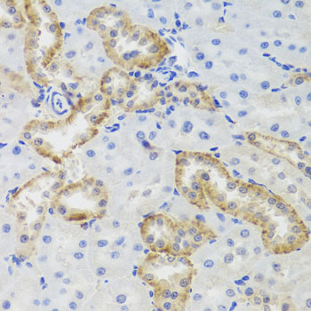 Immunohistochemistry - MTERFD3 Polyclonal Antibody 