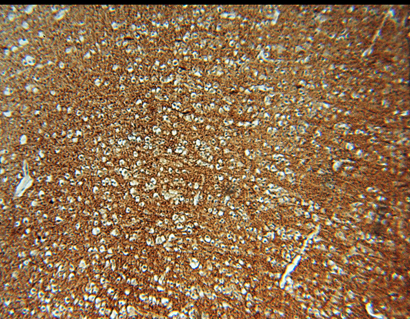 Immunohistochemical of paraffin-embedded human brain using Catalog No:107879(SNCA antibody) at dilution of 1:50 (under 10x lens)