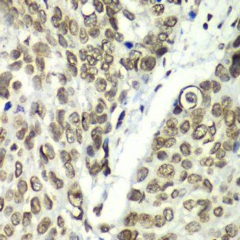 Immunohistochemistry - TEAD1 Polyclonal Antibody 