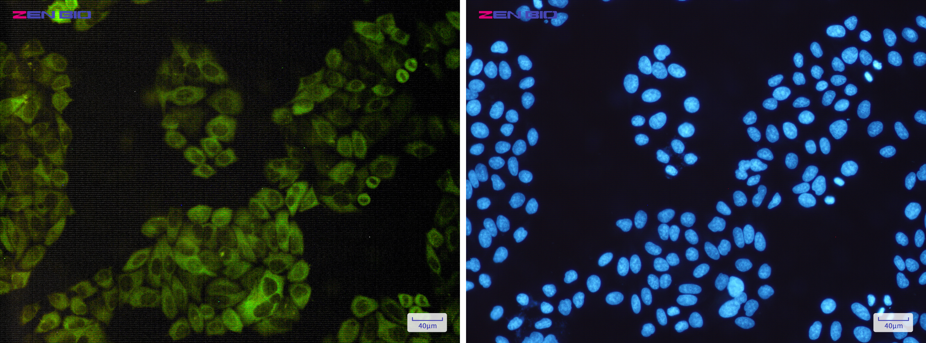 Immunocytochemistry of NFkB p100/NFKB2(green) in Hela cells using NFkB p100/NFKB2 Rabbit pAb at dilution 1/50, and DAPI(blue)