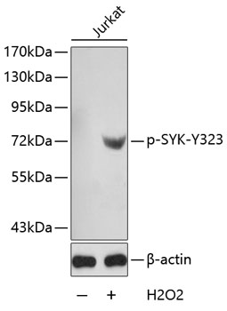 Western blot - Phospho-SYK-Y323 pAb 