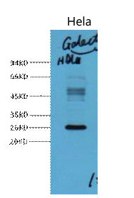 Western blot analysis of Hela, diluted at 1:3000.