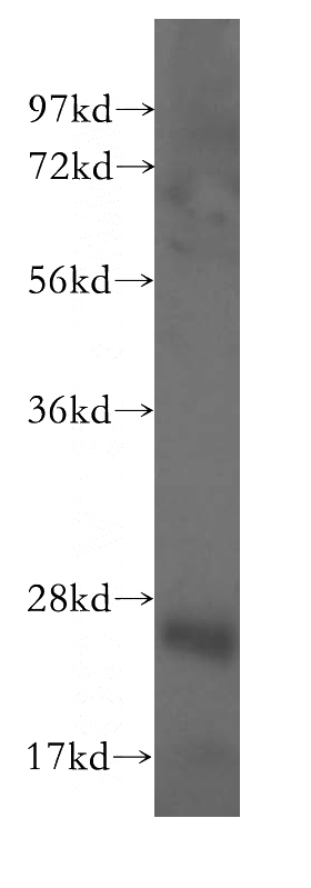 HeLa cells were subjected to SDS PAGE followed by western blot with Catalog No:109262(ITGB3BP antibody) at dilution of 1:600
