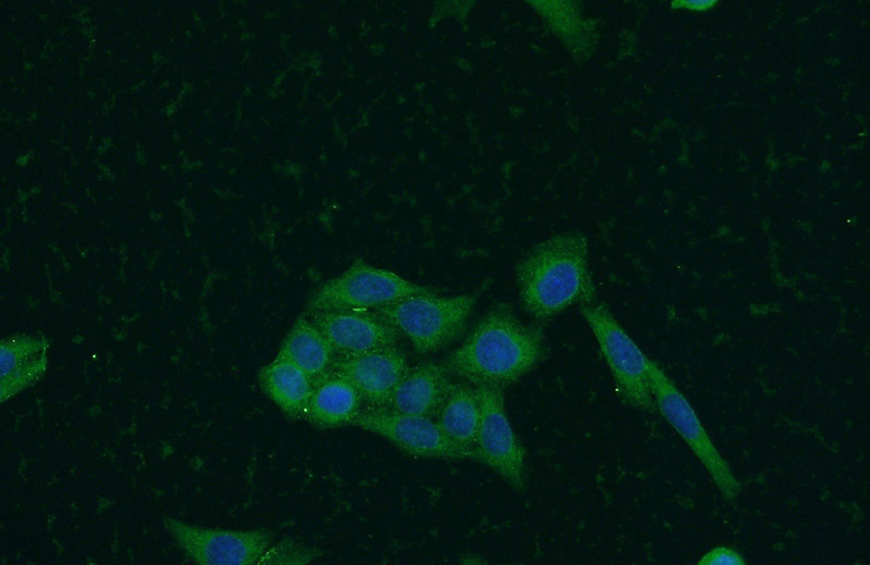 Immunofluorescent analysis of HeLa cells using Catalog No:115487(SOAT2 Antibody) at dilution of 1:50 and Alexa Fluor 488-congugated AffiniPure Goat Anti-Rabbit IgG(H+L)