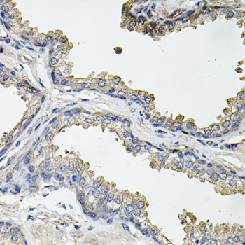 Immunohistochemistry - ACO1 Polyclonal Antibody 