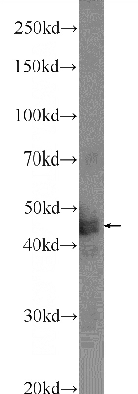 mouse brain tissue were subjected to SDS PAGE followed by western blot with Catalog No:116175(TMEM201 Antibody) at dilution of 1:100