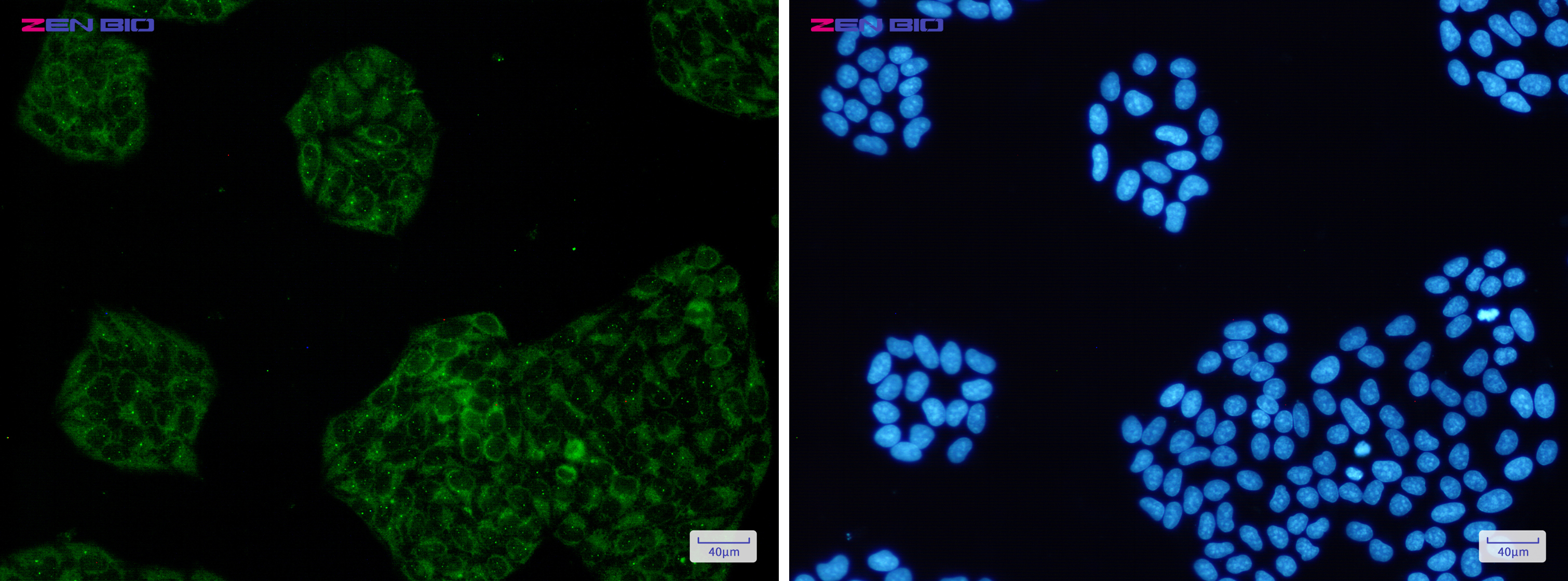 Immunocytochemistry of Amyloid Precursor Protein(green) in Hela cells using Amyloid Precursor Protein Rabbit pAb at dilution 1/50, and DAPI(blue)