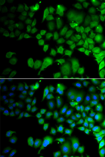 Immunofluorescence - JMJD7 Polyclonal Antibody 