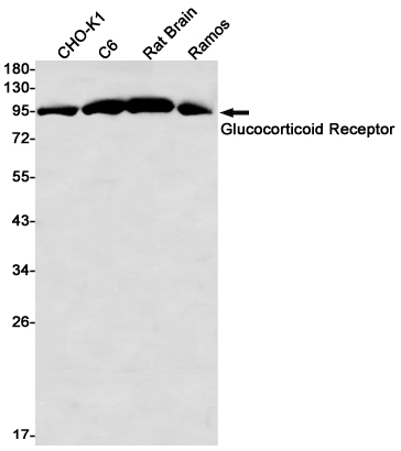 Western blot detection of Glucocorticoid Receptor in CHO-K1,C6,Rat Brain,Ramos cell lysates using Glucocorticoid Receptor Rabbit mAb(1:1000 diluted).Predicted band size:86kDa.Observed band size:86kDa.