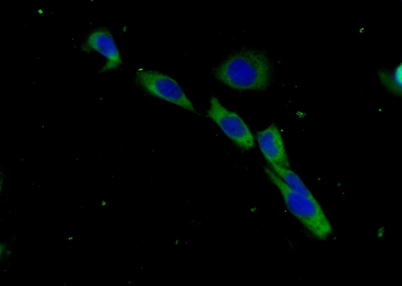 Immunofluorescent analysis of (-20oc Ethanol) fixed A431 cells using Catalog No:117131(B2M Antibody) at dilution of 1:25 and Alexa Fluor 488-congugated AffiniPure Goat Anti-Rabbit IgG(H+L)