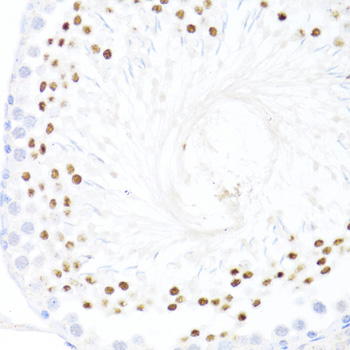 Immunohistochemistry - DDX59 Polyclonal Antibody 