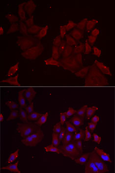 Immunofluorescence - PANX1 Polyclonal Antibody 