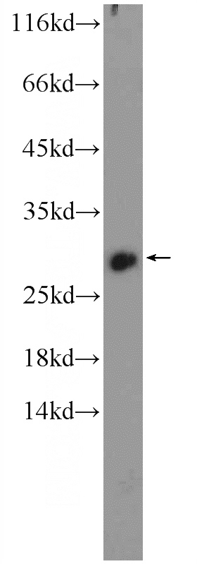 SKOV-3 cells were subjected to SDS PAGE followed by western blot with Catalog No:111534(HOXB7 Antibody) at dilution of 1:300