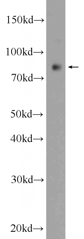 SMMC-7721 cells were subjected to SDS PAGE followed by western blot with Catalog No:114090(PPP1R3F Antibody) at dilution of 1:1000